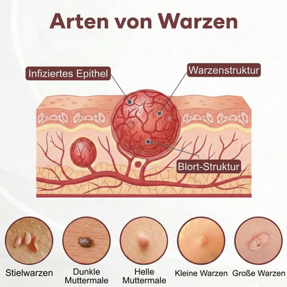 ⭐ Bestseller  | Healrize® Schwarzer Reis Dual-Wirkung Korrekturcreme für Warzen