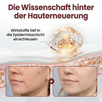 ⭐ Bestseller  | Healrize® Schwarzer Reis Dual-Wirkung Korrekturcreme für Warzen