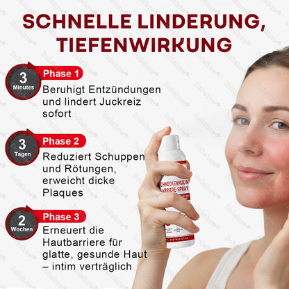 ⭐ Bestseller | Healrize® Schneckenmucin-Barriere-Spray zur Linderung von Hautschüben und zur Regeneration der Haut-𝘿𝙚𝙪𝙩𝙨𝙘𝙝𝙡𝙖𝙣𝙙𝙨 𝙉𝙧. 1 𝙨𝙥𝙧ü𝙝𝙗𝙖𝙧𝙚 𝘽𝙖𝙧𝙧𝙞𝙚𝙧𝙚-𝙋𝙛𝙡𝙚𝙜𝙚 𝙗𝙚𝙞 𝙋𝙨𝙤𝙧𝙞𝙖𝙨𝙞𝙨✨