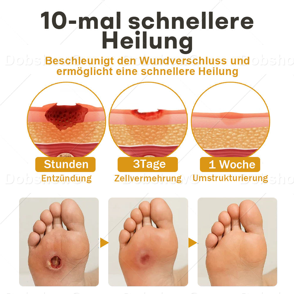 🔥Bestseller🔥Healrize® GlucoShield Bienengift-Wundspray🎉 Zeitlich begrenzter Sonderrabatt