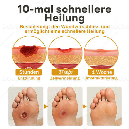 🔥Bestseller🔥Healrize® GlucoShield Bienengift-Wundspray🎉 Zeitlich begrenzter Sonderrabatt
