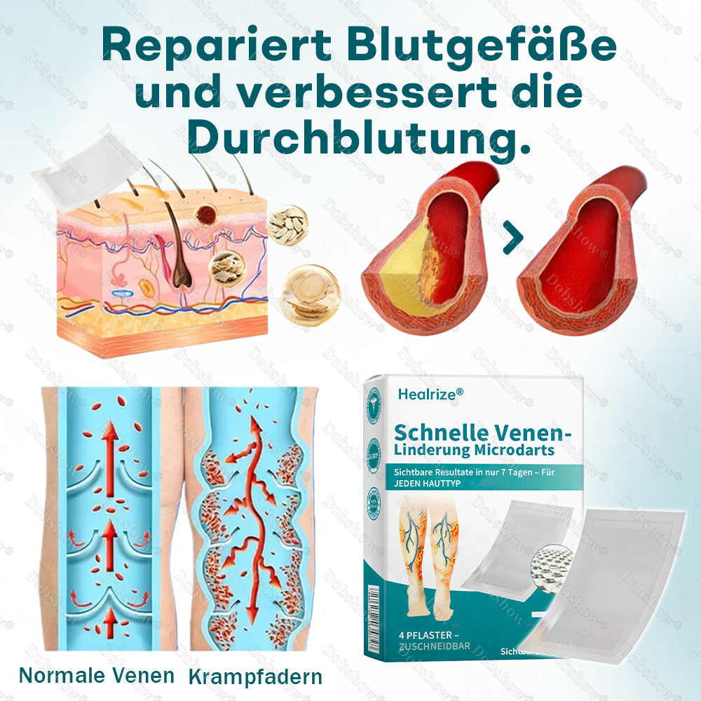 👨‍⚕️✅Healrize® Schnelle Venen-Linderung Microdarts | Sichtbare Resultate in nur 7 Tagen – Für JEDEN HAUTTYP ✨