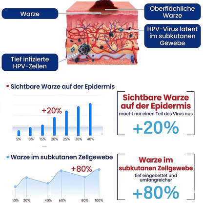 Healrize® Kälte-Spray zur Warzen-Erneuerung &amp; Korrektur——Z