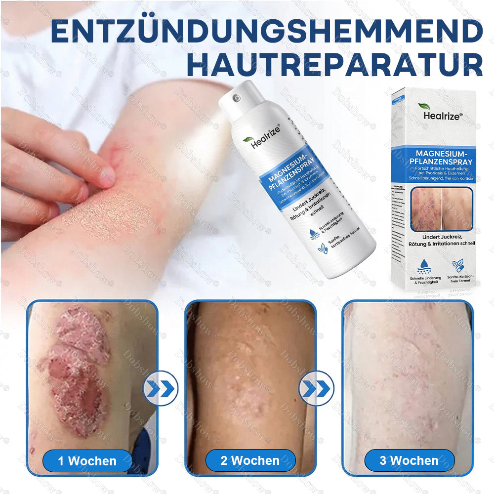✅DE 𝐎𝐟𝐟𝐢𝐜𝐢𝐚𝐥  𝐒𝐭𝐨𝐫𝐞 | Healrize® Magnesium Botanical Spray – Fortschrittliche Hautregeneration bei Psoriasis & Ekzemen | Schnelle Linderung, steroidfrei🌿