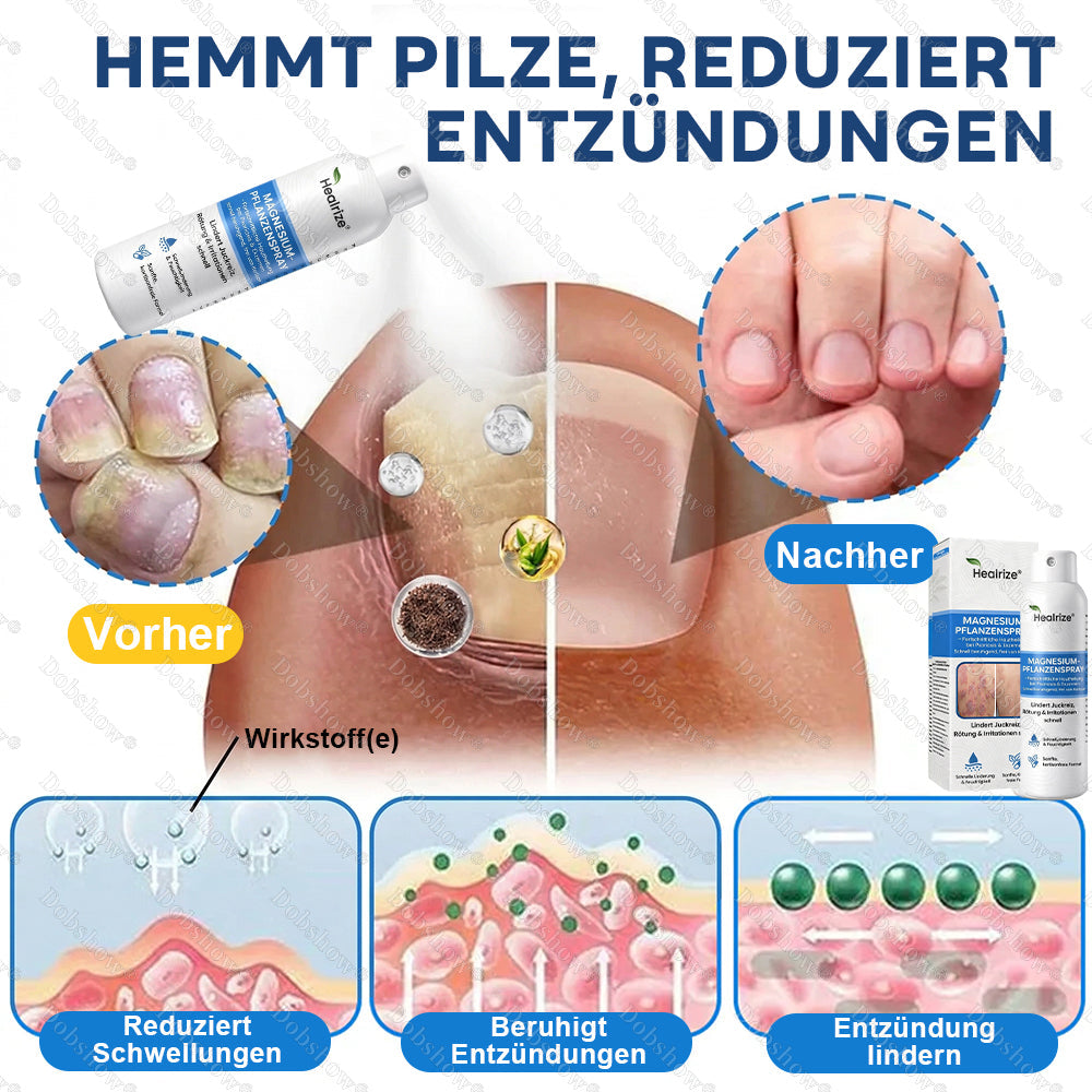 ✅DE 𝐎𝐟𝐟𝐢𝐜𝐢𝐚𝐥  𝐒𝐭𝐨𝐫𝐞 | Healrize® Magnesium Botanical Spray – Fortschrittliche Hautregeneration bei Psoriasis & Ekzemen | Schnelle Linderung, steroidfrei🌿