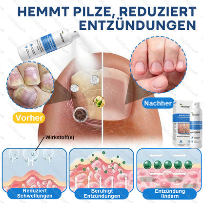 ✅DE 𝐎𝐟𝐟𝐢𝐜𝐢𝐚𝐥  𝐒𝐭𝐨𝐫𝐞 | Healrize® Magnesium Botanical Spray – Fortschrittliche Hautregeneration bei Psoriasis & Ekzemen | Schnelle Linderung, steroidfrei🌿
