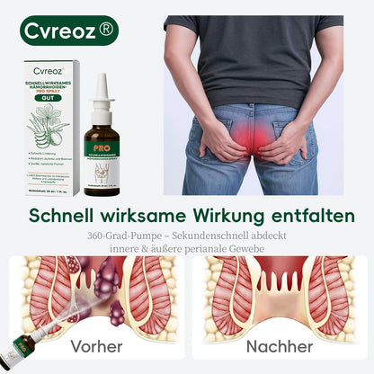 ✨ Neujahrs-Angebot | 𝙲𝚟𝚛𝚎𝚘𝚣® 𝚂𝙲𝙷𝙽𝙴𝙻𝙻𝚆𝙸𝚁𝙺𝚂𝙰𝙼𝙴𝚂 𝙷Ä𝙼𝙾𝚁𝚁𝙷𝙾𝙸𝙳𝙴𝙽-𝙿𝚁𝙾 𝚂𝙿𝚁𝙰𝚈✨