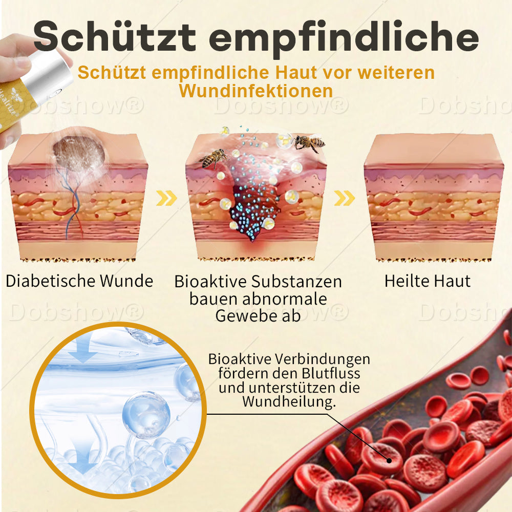 🔥Bestseller🔥Healrize® GlucoShield Bienengift-Wundspray🎉 Zeitlich begrenzter Sonderrabatt