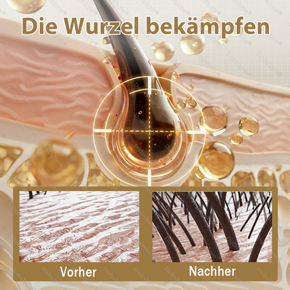 🔥Bestseller🔥Healrize®  Haarwuchs-Kapseln - Nanodurchdringung, tief in die Haarwurzeln 🎉 Zeitlich begrenzter Sonderrabatt