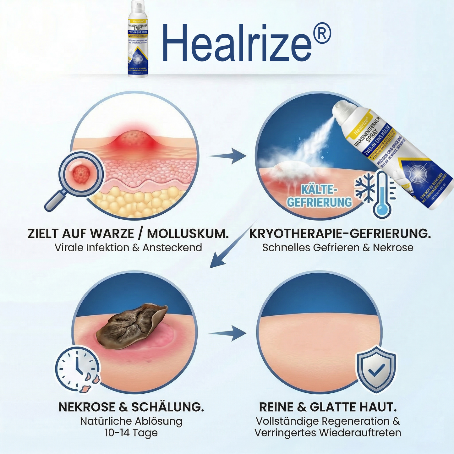 Healrize® Kälte-Spray zur Warzen-Erneuerung &amp; Korrektur——Z