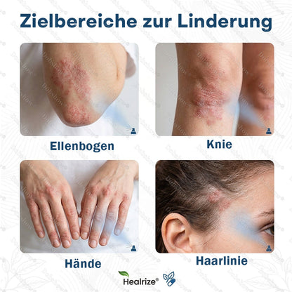 ✅DE 𝐎𝐟𝐟𝐢𝐜𝐢𝐚𝐥  𝐒𝐭𝐨𝐫𝐞 | Healrize® Magnesium Botanical Spray – Fortschrittliche Hautregeneration bei Psoriasis & Ekzemen | Schnelle Linderung, steroidfrei🌿