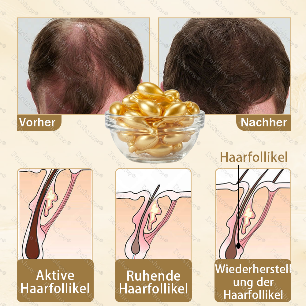 🔥Bestseller🔥Healrize®  Haarwuchs-Kapseln - Nanodurchdringung, tief in die Haarwurzeln 🎉 Zeitlich begrenzter Sonderrabatt