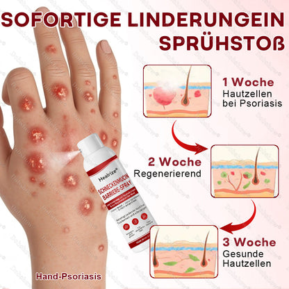 ⭐ Bestseller | Healrize® Schneckenmucin-Barriere-Spray zur Linderung von Hautschüben und zur Regeneration der Haut-𝘿𝙚𝙪𝙩𝙨𝙘𝙝𝙡𝙖𝙣𝙙𝙨 𝙉𝙧. 1 𝙨𝙥𝙧ü𝙝𝙗𝙖𝙧𝙚 𝘽𝙖𝙧𝙧𝙞𝙚𝙧𝙚-𝙋𝙛𝙡𝙚𝙜𝙚 𝙗𝙚𝙞 𝙋𝙨𝙤𝙧𝙞𝙖𝙨𝙞𝙨✨