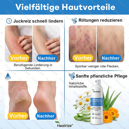 ✅DE 𝐎𝐟𝐟𝐢𝐜𝐢𝐚𝐥  𝐒𝐭𝐨𝐫𝐞 | Healrize® Magnesium Botanical Spray – Fortschrittliche Hautregeneration bei Psoriasis & Ekzemen | Schnelle Linderung, steroidfrei🌿
