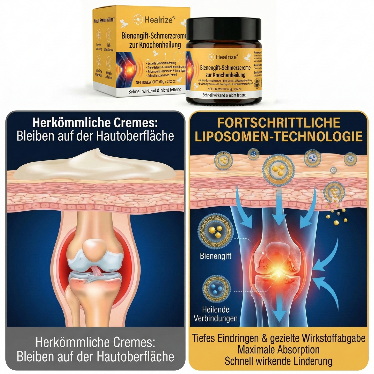 🐝Healrize® Bienengift-Creme – Chronische Gelenkschmerzen schnell beenden-Z