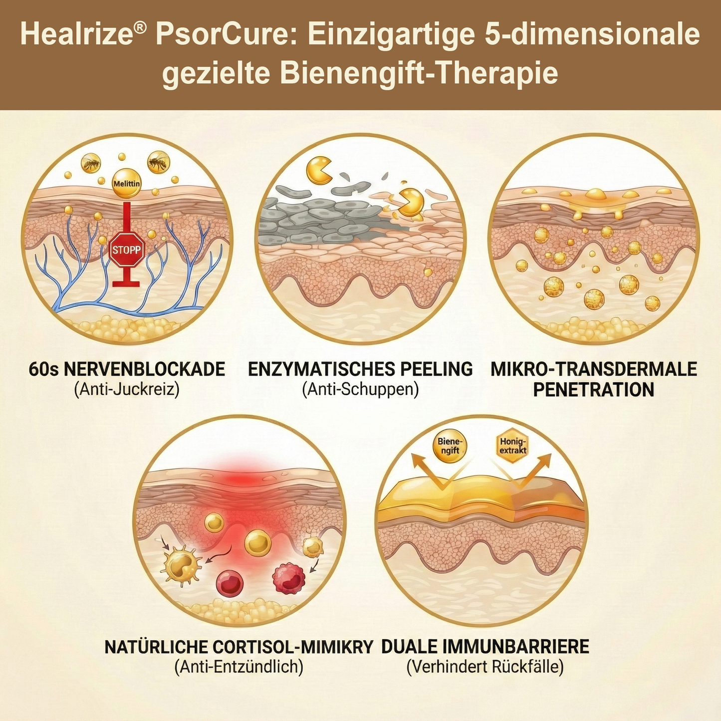 📅👨‍⚕️ 𝙈ä𝙧𝙯-𝘼𝙣𝙜𝙚𝙗𝙤𝙩 | Healrize® PsorCure Bienengift Zielgerichtete Linderungscreme💗