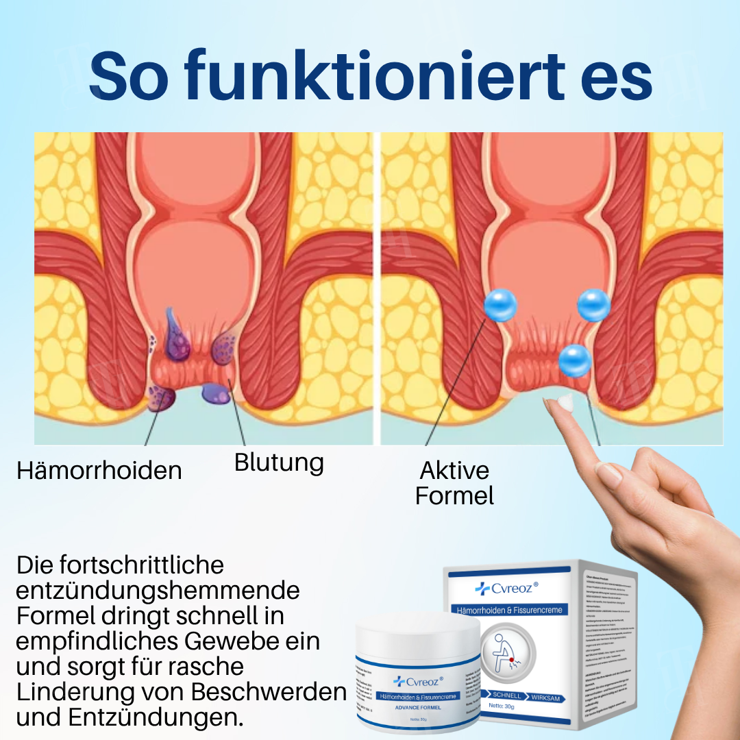 🎁 Exklusives Online-Angebot | Cvreoz® Hämorrhoiden & Fissurencreme
