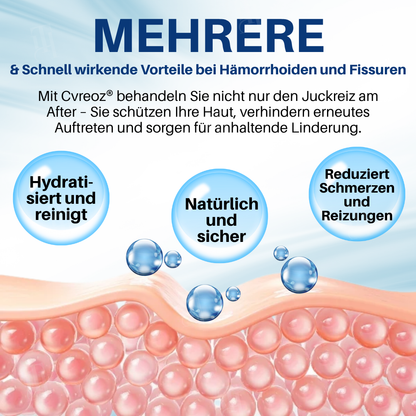 🎁 Exklusives Online-Angebot | Cvreoz® Hämorrhoiden & Fissurencreme
