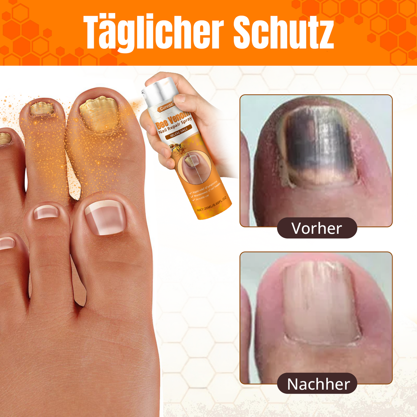 Cvreoz® Bienengift Nagel-Reparatur Spray