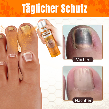 Cvreoz® Bienengift Nagel-Reparatur Spray