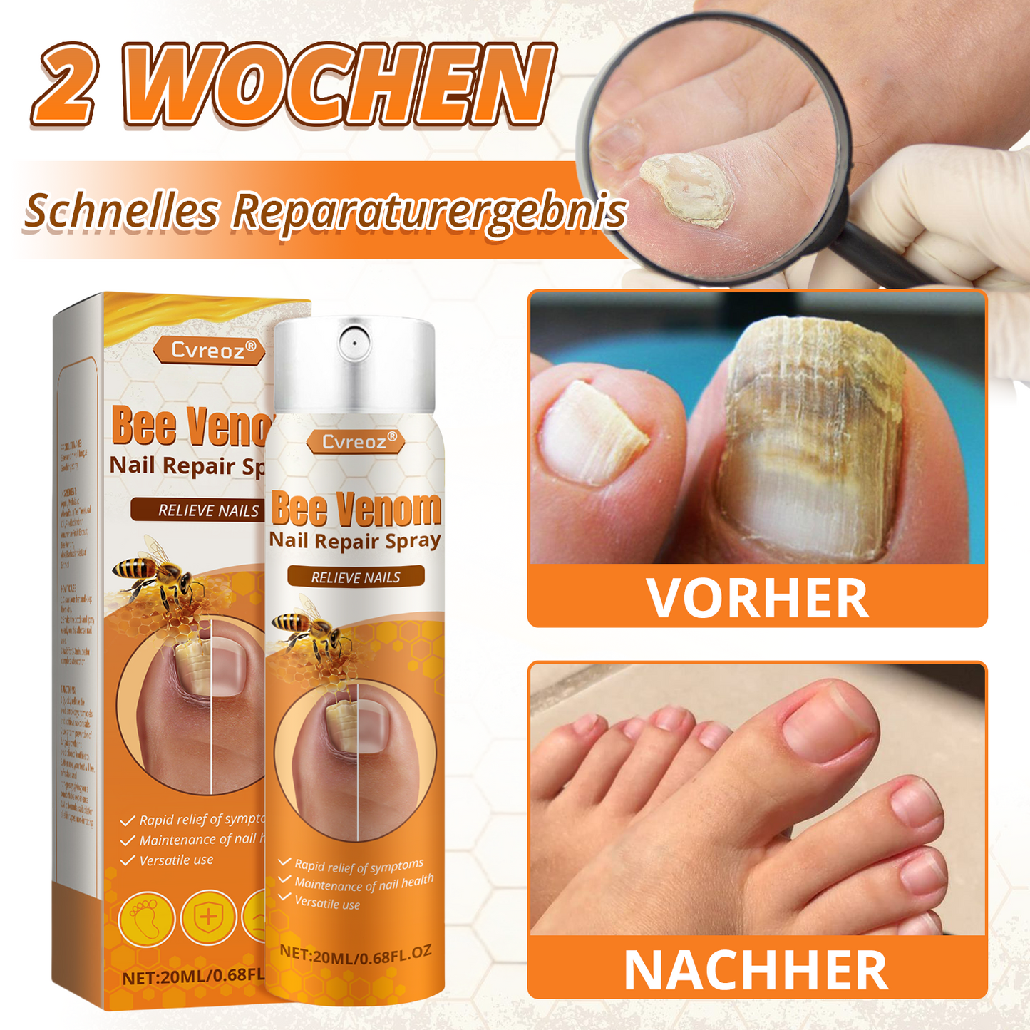 Cvreoz® Bienengift Nagel-Reparatur Spray