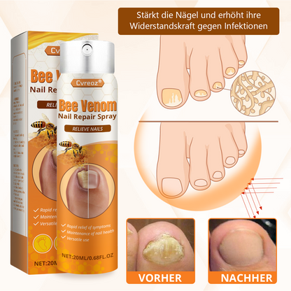 Cvreoz® Bienengift Nagel-Reparatur Spray