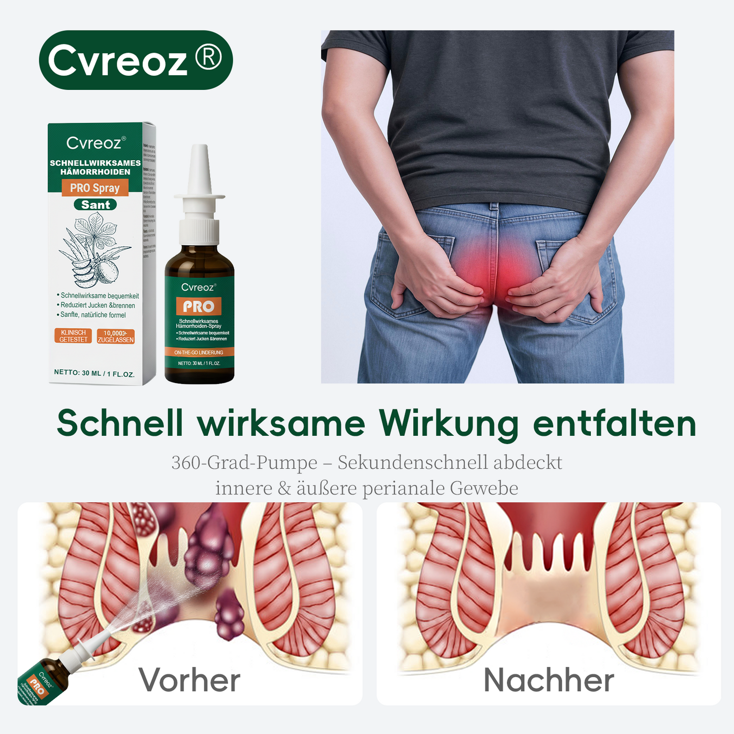 🎄Weihnachts-Sale |Cvreoz® SCHNELLWIRKSAMES HÄMORRHOIDEN-PRO SPRAY
